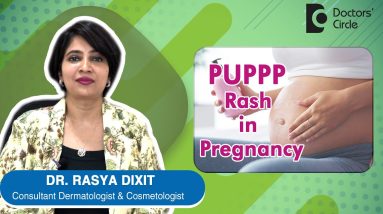 PUPPP Rash in Pregnancy Causes, Symptoms, Prevention & Treatment - Dr. Rasya Dixit | Doctors' Circle 14 1680410835 maxresdefault