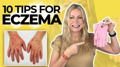 Have Eczema? You Need to Know This.... 6 1680412927 maxresdefault