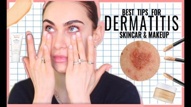 How I Treat My Dermatitis + Makeup for Dermatitis / Eczema | Ruby Golani 18 1680415086 maxresdefault