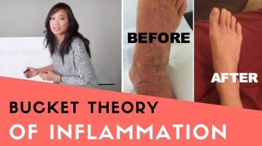 Why Eczema Inflammation Happens: The Bucket Theory (Sneak Preview of Conqueror Eczema Academy!) 20 1680420076 maxresdefault