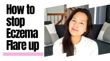 How to STOP ECZEMA Flare Up I How to heal Eczema from the inside out 6 1680423815 maxresdefault