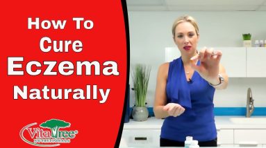 Eczema Treatment : How To Treat Eczema Naturally - VitaLife Show Episode 215 14 1680426792 maxresdefault