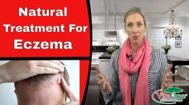 Eczema : Natural Treatment for Eczema - VitaLife Show 143 12 1680427560 maxresdefault