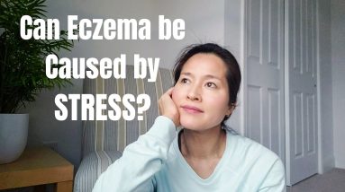 Can Eczema be Caused by Stress? 10 1680428017 maxresdefault