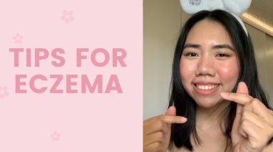 Tips for Eczema | FaceTory 20 1680448956 maxresdefault