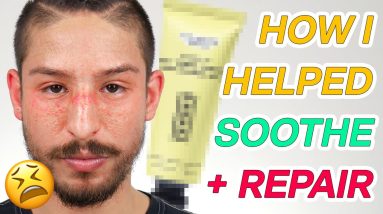 I Got Allergic/Photo Contact Dermatitis: What Caused It + How I Remedied It 18 1680449036 maxresdefault