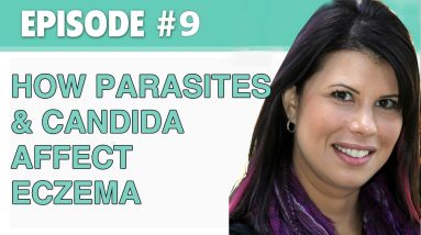 The Eczema Podcast S1E9: How Parasites and Candida Affect Your Eczema 12 1680467397 maxresdefault