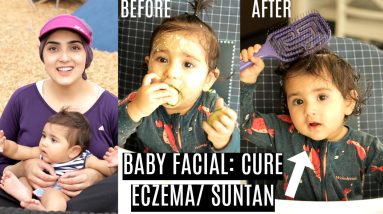 BEST BABY/CHILDREN FACIAL (BOYS/GIRLS) | Remove Eczema, Dryness, Acne + Suntan NATURALLY ~ Immy 20 1680470548 maxresdefault