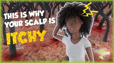 Why your scalp is so damn ITCHY 20 1680476329 maxresdefault