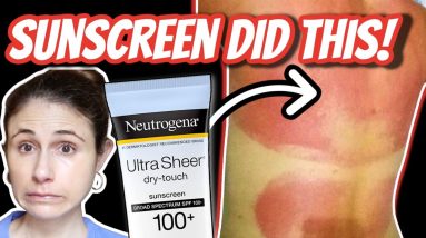 SUNSCREEN allergic reactions and rashes| Dr Dray 16 1680477235 maxresdefault