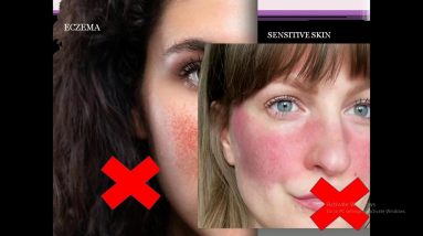 Acne, Sensitive/Dry Skin, Eczema !!! REASON IS PH ? What is "PH" 6 1680480003 maxresdefault