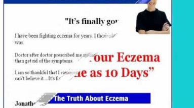 Eczema -eczema blisters - It's for you! 2 1680481503 hqdefault