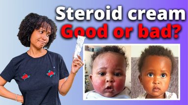 The Truth About Steroid Cream For Baby Eczema 20 1680481743 maxresdefault