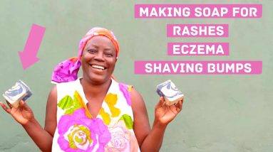 Making All Natural Anti Rashes Soap / Part 2/ Skin Rashes, / Eczema/ Pimples and Shaving Bumps 16 1680482376 maxresdefault