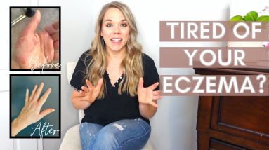 Topical Treatment for Eczema | How pH and Eczema Are Related 2 1680486151 maxresdefault