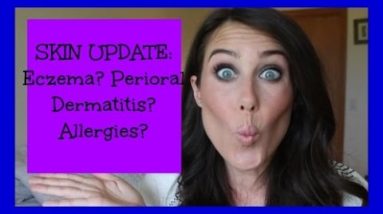 Eczema? Perioral Dermatitis? Allergies?.....Update What's Been Going On With My SKIN!? 10 1680495346 hqdefault
