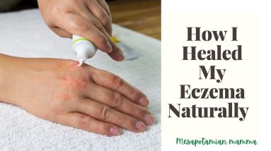 How I healed my eczema naturally: Proven Steps to Get Rid of Eczema Atopic Dermatitis 14 1680499590 maxresdefault