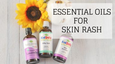 Essential Oils for Skin Rash | Eczema, DIAPER RASH | Bumblebee Apothecary 8 1680500899 maxresdefault
