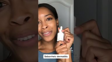 So, what is Seborrheic dermatitis? 2 1680502729 maxresdefault