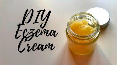 DIY Eczema Cream 16 1680503849 maxresdefault