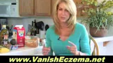 The Various Causes of Eczema - Identify These and Know How to Treat It 10 1680505287 hqdefault