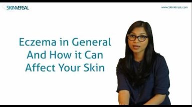 Eczema - General Causes and Treatment 16 1680509173 hqdefault