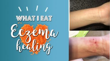 Eczema Diet: What I Eat in a Day | Michelle Mills 14 1680510083 maxresdefault