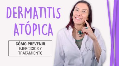 Dermatitis Atópica | Cómo Curar la Piel Atópica 12 1680510942 maxresdefault