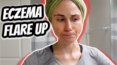 Vlog: Eczema flare up, shopping for gifts, & iHerb mini HAUL | Dr Dray 14 1680515041 maxresdefault