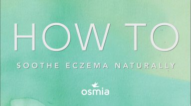 How To Soothe Eczema Naturally 16 1680520149 maxresdefault