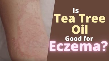 Is Tea Tree Oil Good for Eczema? Helps Eczema Symptom Relief 6 1680527859 maxresdefault
