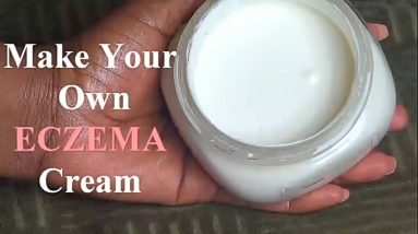 Eczema Be Gone!!! How To Make Your Own Eczema Cream 10 1680537923 maxresdefault