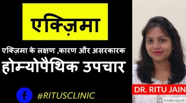 ECZEMA -SYMPTOMS,CAUSES & TREATMENT एक्ज़िमा के लक्षण ,कारण और असरकारक होम्योपैथिक उपचार 10 1680544082 maxresdefault