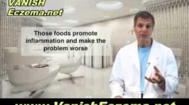 How to Get Rid of Eczema on Elbows and Any Other Part of Your Body 18 1680547448 hqdefault