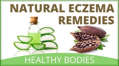 How To Treat Eczema Naturally | Top Home Remedies For Eczema 16 1680547712 maxresdefault