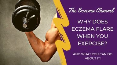 Why Does Eczema Flare When You Exercise? 2 1680551579 maxresdefault