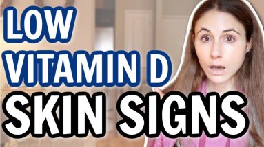 Skin SIGNS OF LOW VITAMIN D @DrDrayzday 16 1680552954 maxresdefault