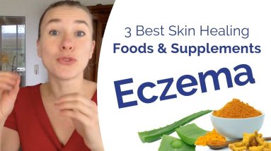 Eczema Treatment - The 3 Best Foods & Supplements to Boost Your Skin Healing 8 1680555486 maxresdefault