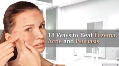 18 Ways to Beat Eczema, Acne, and Psoriasis 16 1680559045 hqdefault