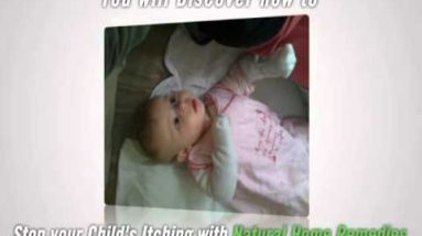 Cure Child Eczema 4 1680562164 hqdefault