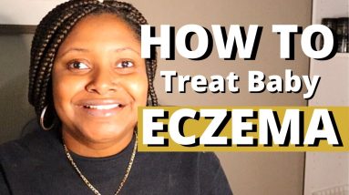 What is Baby Eczema and how to treat it? Tamika L Bennett 18 1680563565 maxresdefault