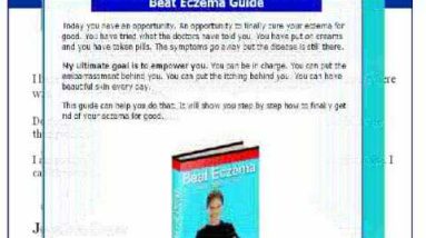 Eczema -eczema and children - See now! 10 1680565870 hqdefault