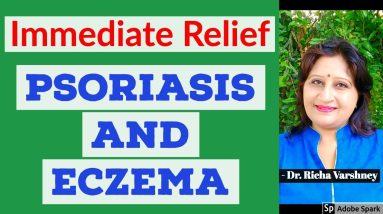 Psoriasis Treatment | Eczema Treatment | Skin Disorder | Home Remedies for Skin Allergies 12 1680571237 maxresdefault