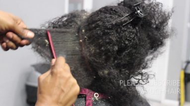 Picking BIG scalp flakes Psoriasis and Dermatitis SEW IN WEAVE REMOVAL 6 1680572178 maxresdefault