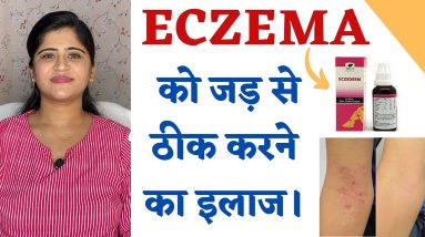 Eczema Treatment ॥ Skin Allergy और Eczema को जड़ से ठीक करने का इलाज ॥ 4 1680572527 maxresdefault
