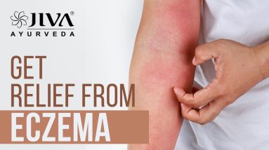 Get Relief from Eczema | एक्जिमा से राहत | Jiva Health Show 2 1680574467 maxresdefault