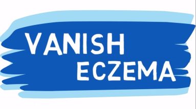 Eczema Cure: A Natural and Proven 3 Step System 6 1680583339 maxresdefault