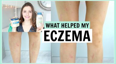 PRODUCTS THAT HELPED MY ECZEMA 2 1680583561 maxresdefault