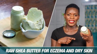 RAW SHEA BUTTER FOR ECZEMA And Dry Skin|BEST Solution For My Kid's Eczema 20 1680585900 maxresdefault