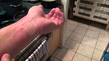 Ringworm and Eczema Nail polish cure - Part 1 4 1680590253 maxresdefault